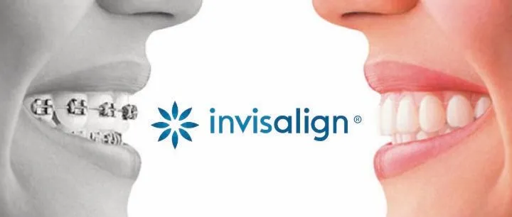 An image of two people smiling one with braces one with invisalign