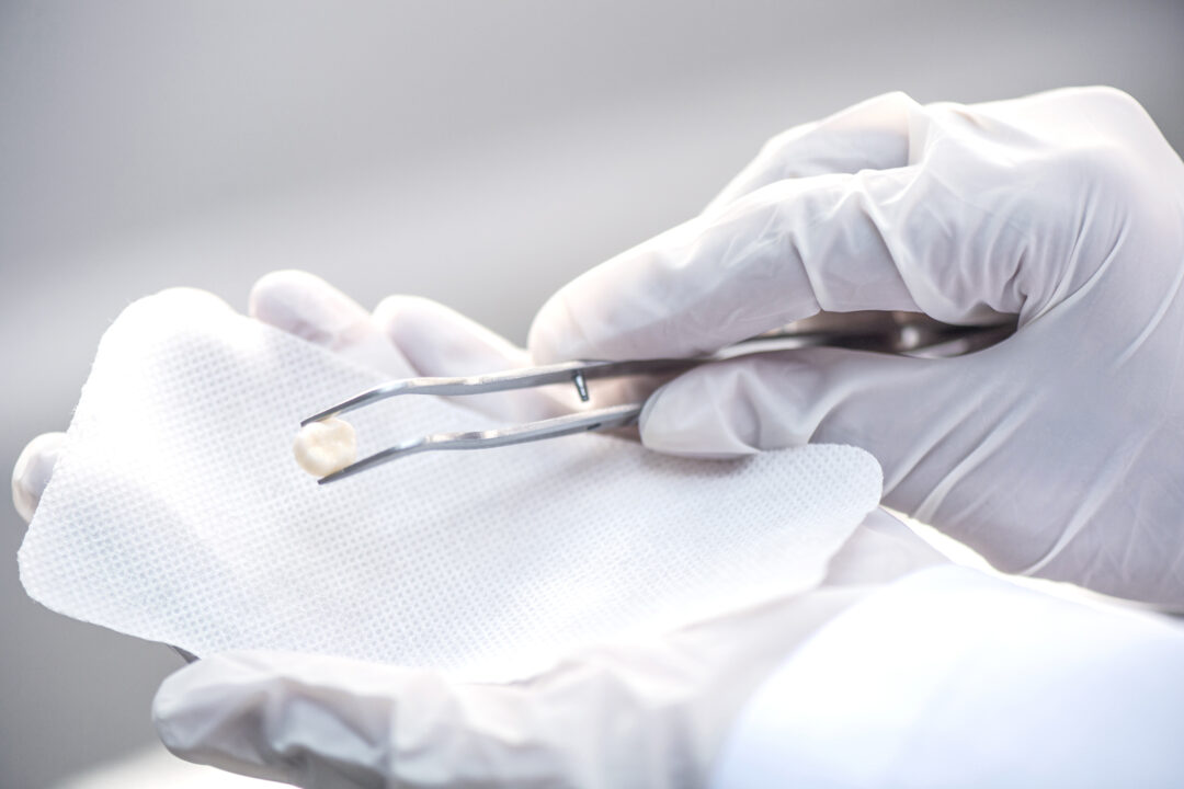 A photo of a dental patient being treated in a dentist room