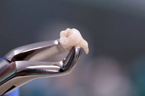 A close up of a person in a dental chair receiving dental treatment